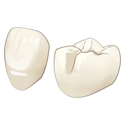 オールセラミック