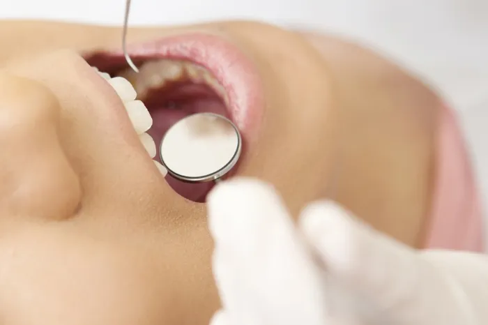 口腔内チェック