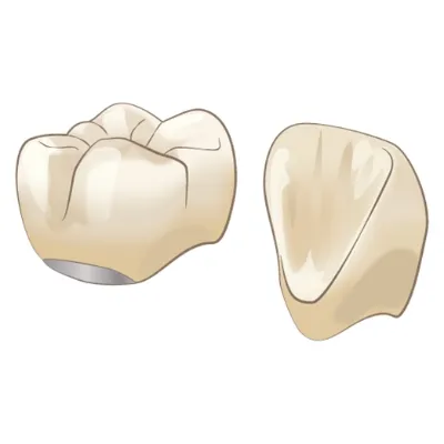 ハイブリッドセラミック